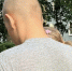 В Тольятти 5-летняя девочка пострадала под колесами электросамоката - TLT.Ru